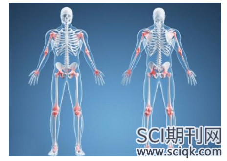 关节损伤论文怎么投SCI期刊